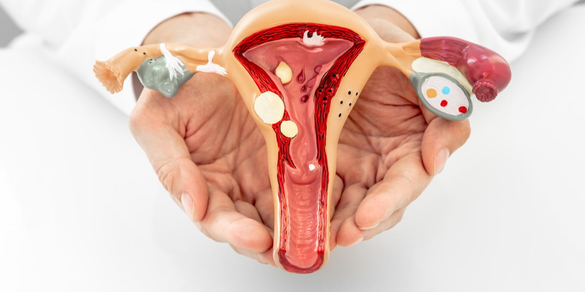 11 Penyakit yang Dapat Menyerang Sistem Reproduksi Wanita - Yoona