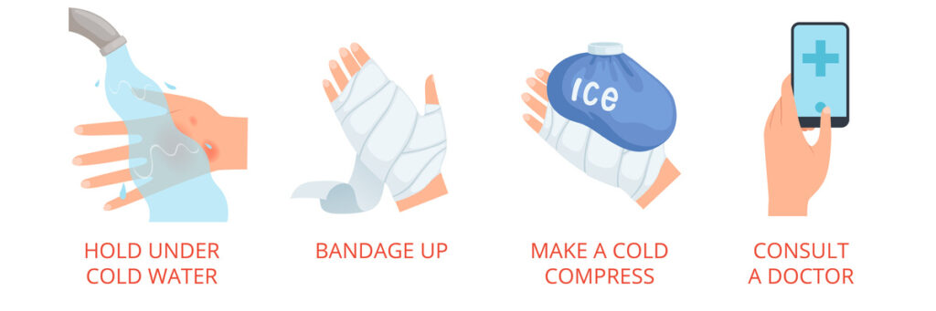 pertolongan pertama cara mengobati luka bakar