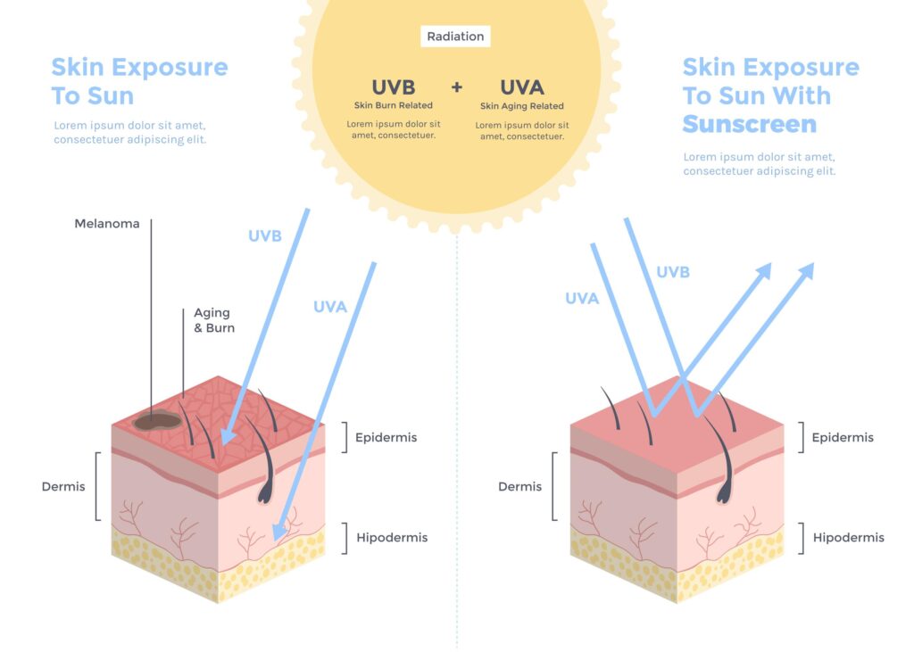 sunscreen untuk kulit berminyak dan berjerawat