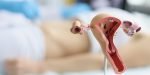 Atonia Uteri adalah Kondisi Serius, Berikut Cara Mengobatinya!