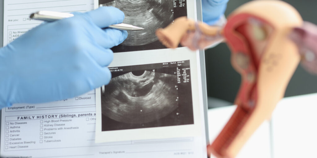 fungsi usg transvaginal