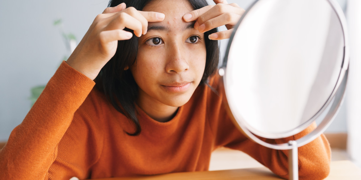 mitos dan fakta pil kb untuk jerawat