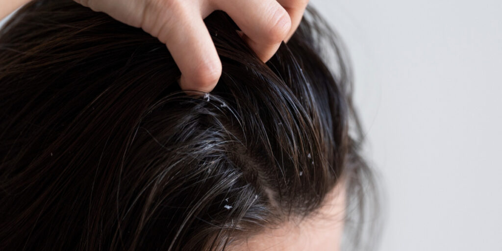 kondisi tambut lepek