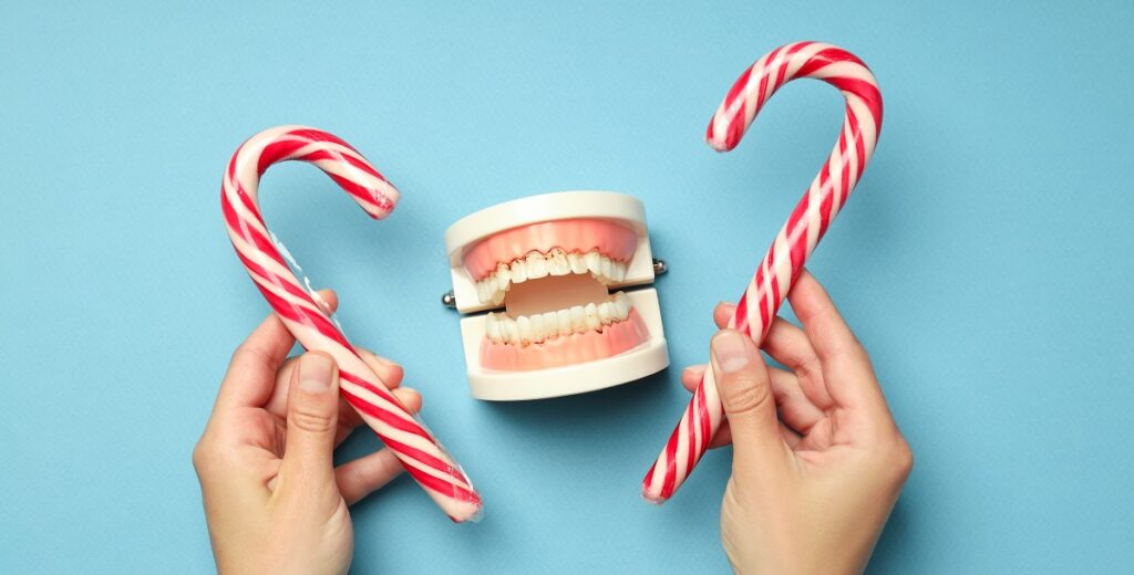 Penyebab sakit gigi berlubang