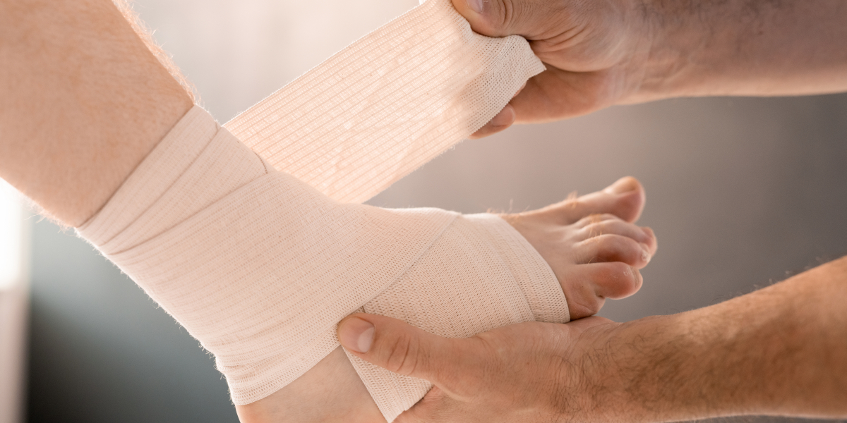 cara mengobati kaki keseleo