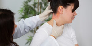 psoriasis kulit kepala