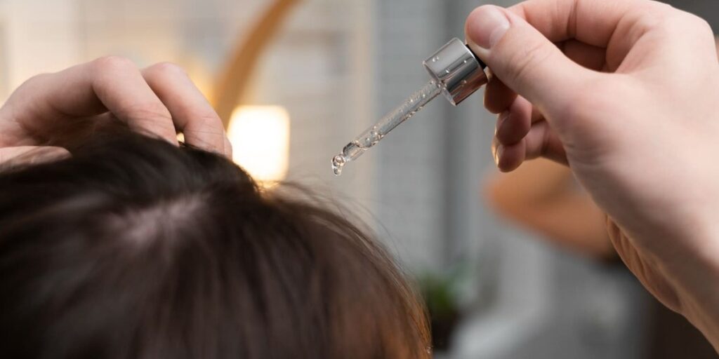 cara menghilangkan ketombe dan rambut rontok