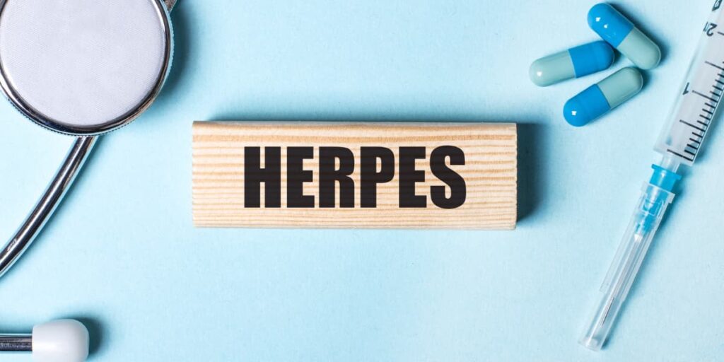 makanan untuk penderita herpes