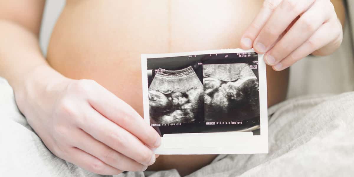 cara hamil anak kembar apakah ada