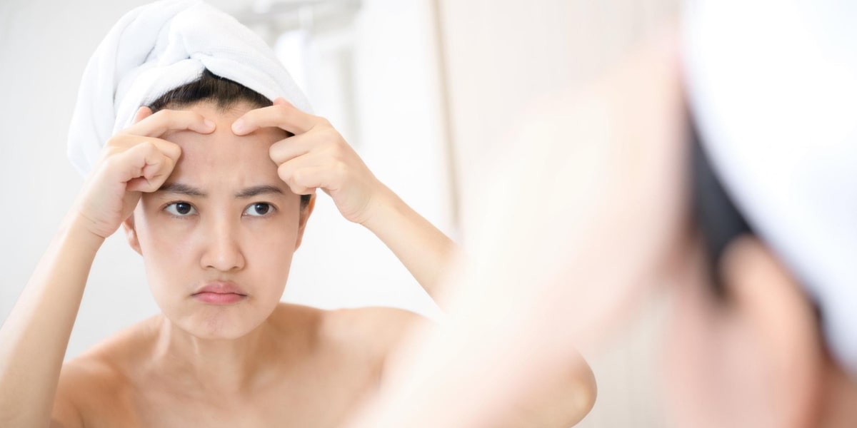 cara mengatasi beruntusan di jidat