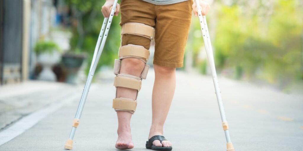 ciri ciri patah tulang mau sembuh