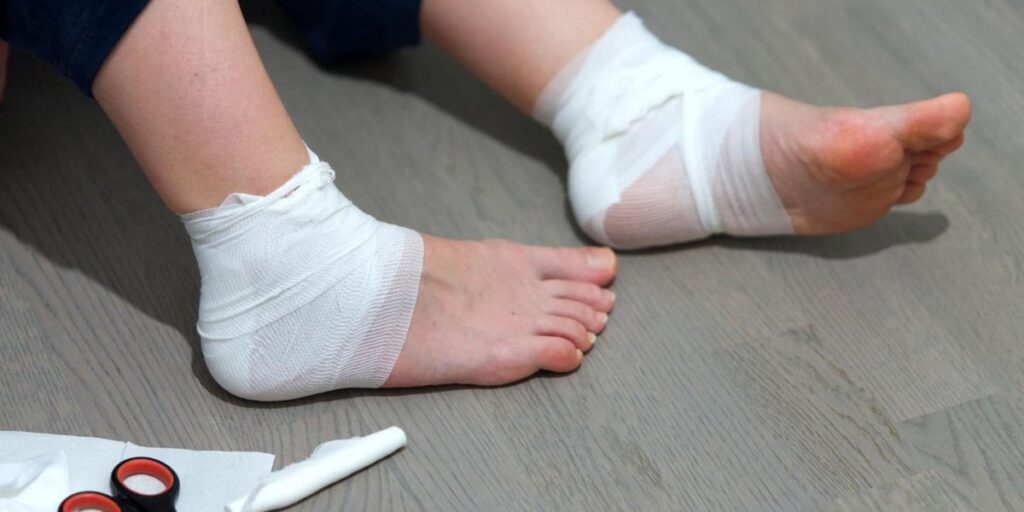 3 Ciri-Ciri Luka Diabetes yang Mau Sembuh, Ini Penjelasannya! - Yoona