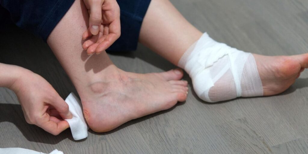 ciri ciri luka diabetes mau sembuh