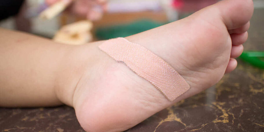 luka diabetes mau sembuh