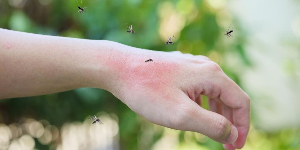 ciri ciri nyamuk dbd