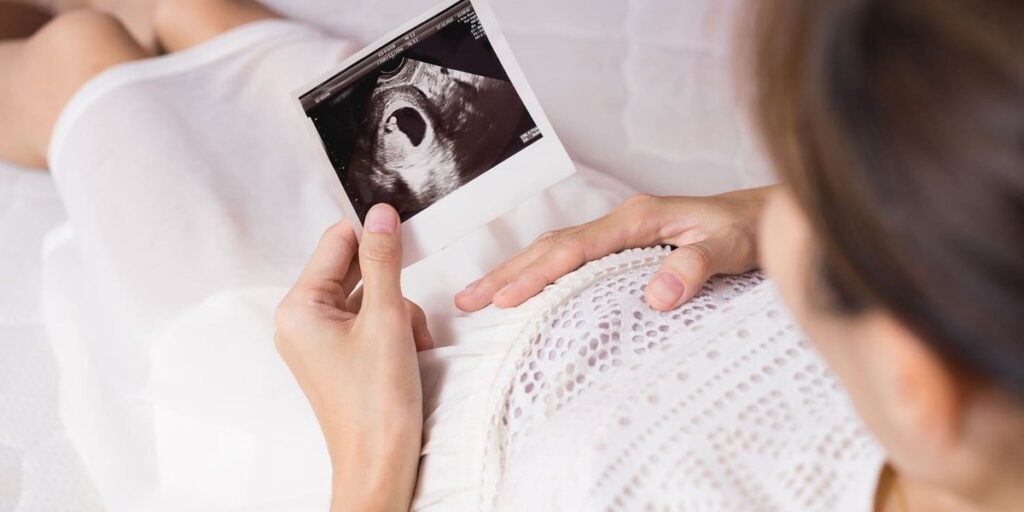 mengenal apa itu anencephaly