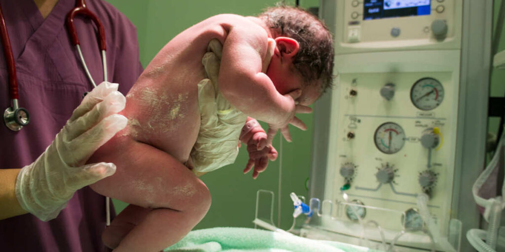 spina bifida adalah