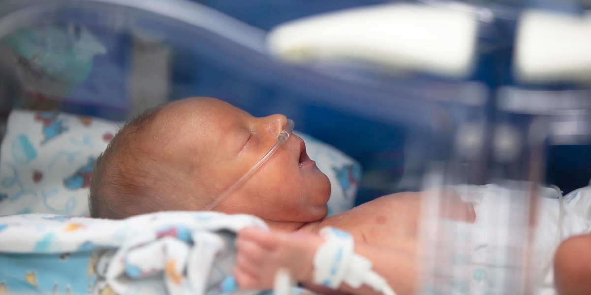 tanda bibir sumbing pada bayi