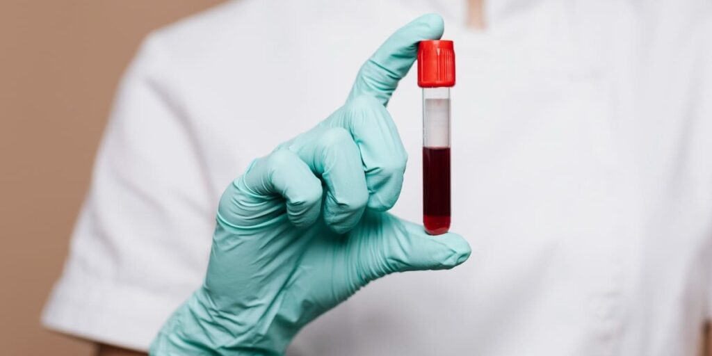 thalasemia minor adalah