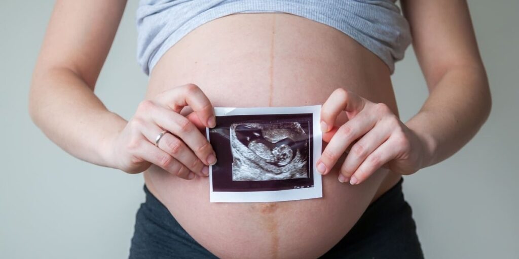 apa itu plasenta akreta