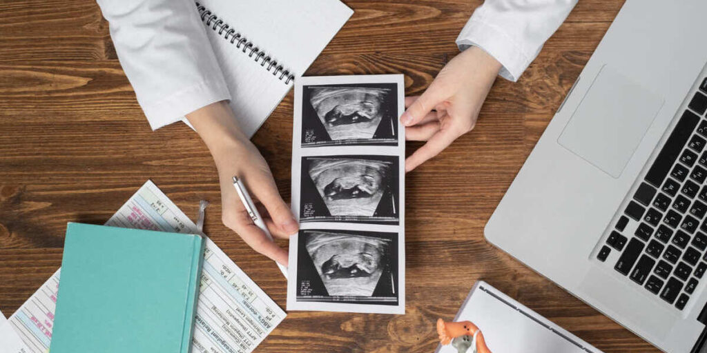 diagnosis plasenta akreta