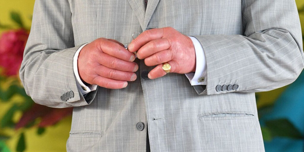 sausage finger