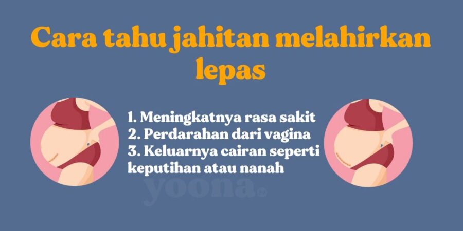Berapa Lama Jahitan Setelah Melahirkan Bisa Sembuh?