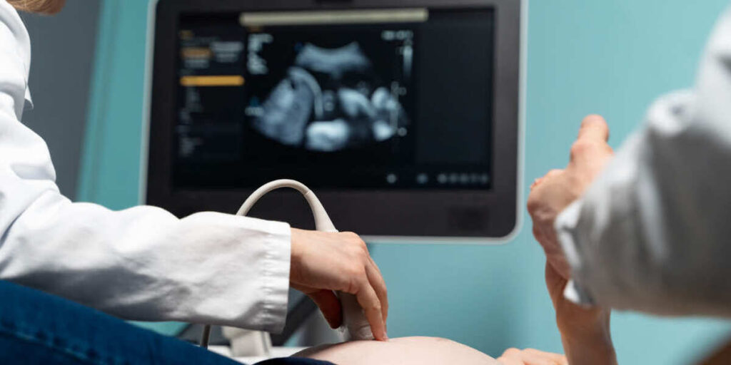 cara mengetahui bayi sungsang