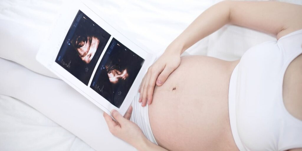 penyebab posisi bayi sungsang