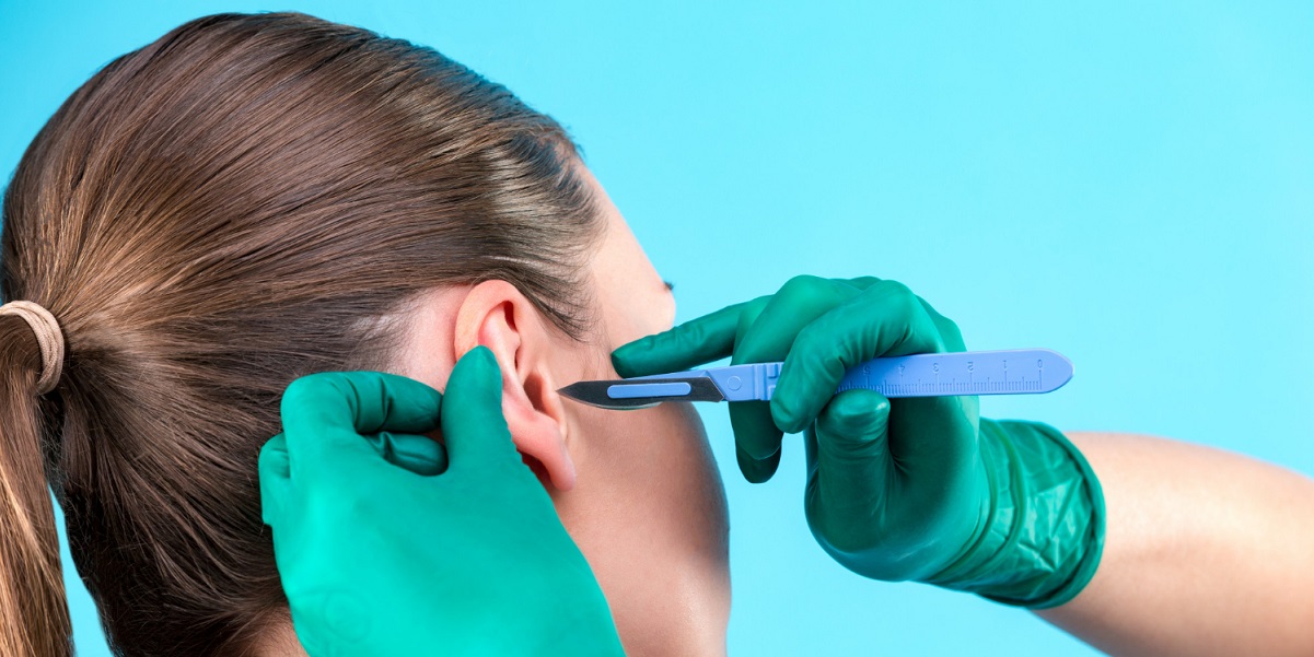 cara mengeluarkan kapas dari telinga dengan mudah dan aman