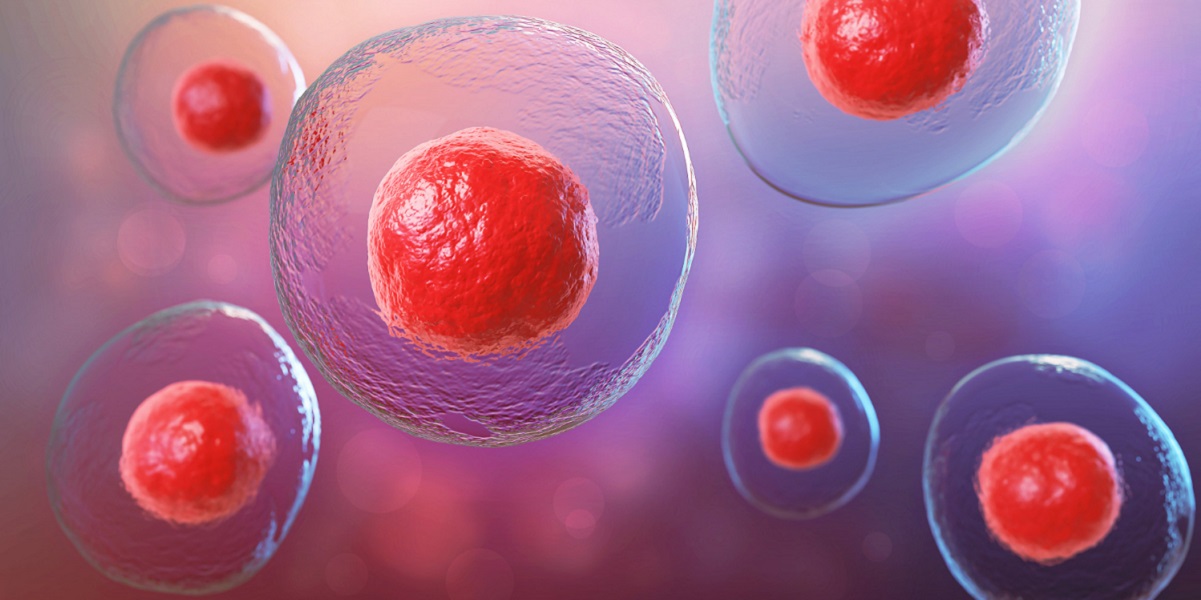 gejala penyebab anemia aplastik dan pengobatannya