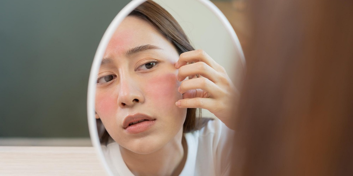 apakah begadang menyebabkan jerawat akibat sering begadang